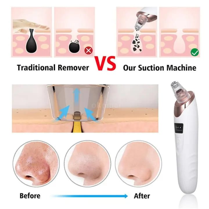 Face Vacuum Suction Blackhead Remover Pore Cleaner Electric Deep Cleansing Tool For Nose And Face.